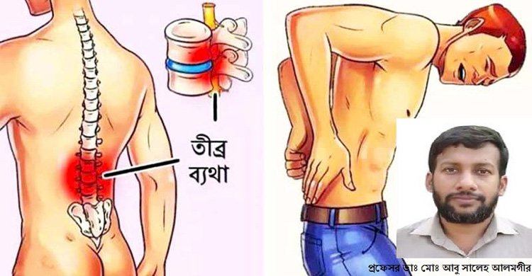 ব‍্যাকপেইনের কারন ও প্রতিরোধে করনীয়