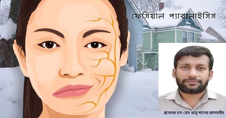 বেল্স পালসি বা মুখ বেঁকে যাওয়ায় ফিজিওথেরাপি মেডিসিন এন্ড রি-হ্যাবিলিটেশন চিকিৎসা