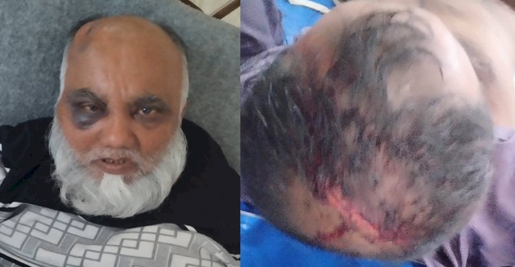 সাতক্ষীরা কলারোয়ায় জমি দখলকে কেন্দ্র করে প্রতিপক্ষের হামলায়  আহত ৩ জন ॥ থানায় মামলা নেয়ার নির্দেশ আদালতের>
</div>
</div>
<div class=