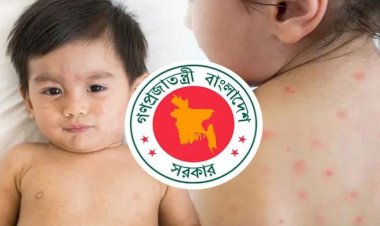 হাম উপসর্গে আরও ৪ শিশুর মৃত্যু